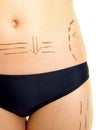 Marks on abdomen and thigh for cosmetic surgery