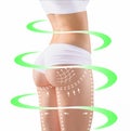 Marks on the women`s buttocks, waist and legs before plastic surgery. Royalty Free Stock Photo