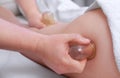The masseur makes massage with jars of cellulite on the buttock and thighs of the patient.