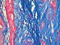 Histology of the Human Breast seen with 3 colors