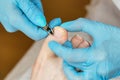 Master chiropody removes cuticle