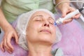 Mature female, rf skin tightening. Royalty Free Stock Photo