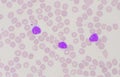 Mature lymphocyte on red blood cells background