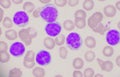 Mature lymphocyte on red blood cells background