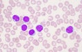 Mature lymphocyte on red blood cells background