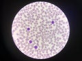 Mature lymphocytes on red blood cells background