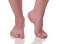 Mature man barefoot with dry skin