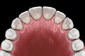 Maxillary human gum and teeth. Medically accurate tooth illustration