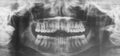 Maxilofacial X-Ray for a dentist treatment. Orthodontics diagnosis.