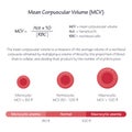 Mean Corpuscular Volume MCV medical vector illustration graphic