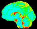 Mean Diffusivity Brain Map in Sagittal View Royalty Free Stock Photo