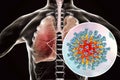 Measles viruses in human respiratory system