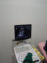 Measurement of the dimensions of the baby in the womb of a pregnant woman using medical ultrasound