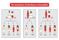 The mechanism of inheritance of hemophilia. Infographics. Vector illustration on background