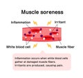 Mechanism of muscle soreness vector illustration