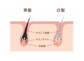 Mechanism of pigmented hair and gray hair / comparison vector illustration / Japanese