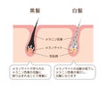 Mechanism of pigmented hair and gray hair / comparison vector illustration / Japanese