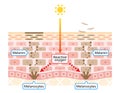 Mechanism of skin cell turnover illustration. Melanin and melanocytes in human skin layer. beauty and skin care