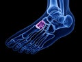 the medial cuneiform bone Royalty Free Stock Photo