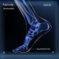 Medial view x ray of bones the of foot with sesamoid.