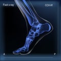 Medial view x ray of bones the of foot.