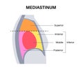 Mediastinum infographic poster