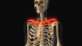 Medical animation of the clavicle bone pain