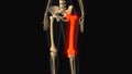 Medical animation of the femur bone pain Royalty Free Stock Photo