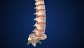 Medical animation of a herniated disc in the lumbar spine Royalty Free Stock Photo