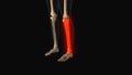 Medical animation of the tibia fibula bone pain