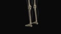 Medical animation of the tibia fibula bone pain