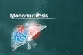 Medical banner Mononucleosis on blue background