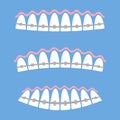 Medical Braces Teeth. Dental Care Background. Orthodontic Treatment. Cartoon Opening Mouth Royalty Free Stock Photo