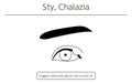 Medical Clipart, Line Drawing Illustration of Eye Disease and Sty, chalazia