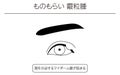 Medical Clipart, Line Drawing Illustration of Eye Disease and Sty, chalazia