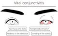 Medical Clipart, Line Drawing Illustration of Eye Disease and Viral conjunctivitis