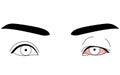 Medical Clipart, Line Drawing Illustration of Eye Disease and Viral conjunctivitis - Translation: Viral conjunctivitis, eye mucus