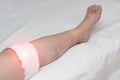 Medical compress on the knee joint in a woman, treatment of the knee with traditional medicine, close-up, inflammation