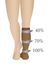 Medical compression hosiery