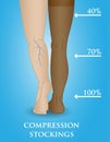 Medical compression hosiery