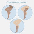 Medical compression hosiery Royalty Free Stock Photo