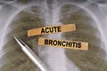 On a human chest x-ray, a pen and strips of paper labeled - Acute bronchitis