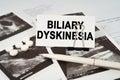 On the ultrasound pictures there is a pen and a business card with the inscription - Biliary dyskinesia