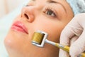 Medical cosmetic procedure