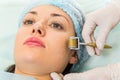 Medical cosmetic procedure Royalty Free Stock Photo