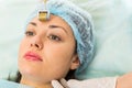 Medical cosmetic procedure