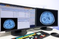 CT or MRI or PET Brain Scan film on a computer monitor. Technologically advanced and functional medical office Royalty Free Stock Photo