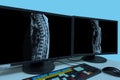 CT or MRI or PET Thoracici spine Scan film on a computer monitor. Technologically advanced and functional medical office Royalty Free Stock Photo