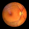 Healthy retina, 3D illustration