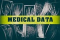 MEDICAL DATA on barricade tape with human body parts x-ray as background Royalty Free Stock Photo